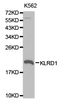 KLRD1 / CD94 Antibody - Western blot of extracts of K562 cell lines, using KLRD1 antibody.