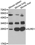 KLRD1 / CD94 Antibody - Western blot analysis of extracts of K562 cell lines.