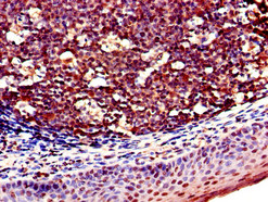 KLRD1 / CD94 Antibody - Immunohistochemistry of paraffin-embedded human tonsil tissue using KLRD1 Antibody at dilution of 1:100