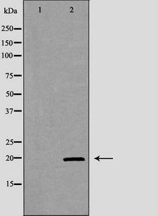KLRD1 / CD94 Antibody - Western blot analysis of extracts of K562 cells using KLRD1 antibody. The lane on the left is treated with the antigen-specific peptide.