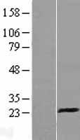 KLRD1 / CD94 Protein - Western validation with an anti-DDK antibody * L: Control HEK293 lysate R: Over-expression lysate