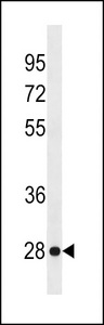 KLRF2 Antibody - KLRF2 Antibody western blot of ZR-75-1 cell line lysates (35 ug/lane). The KLRF2 antibody detected the KLRF2 protein (arrow).