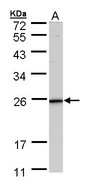KLRG1 Antibody - Sample (30 ug of whole cell lysate). A: HeLa. 12% SDS PAGE. KLRG1 antibody diluted at 1:1000