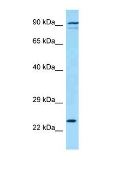 KLRK1 / CD314 / NKG2D Antibody - KLRK1 / NKG2D antibody Western blot of 8226 Cell lysate. Antibody concentration 1 ug/ml.  This image was taken for the unconjugated form of this product. Other forms have not been tested.