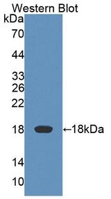 KLRK1 / CD314 / NKG2D Antibody - Western blot of KLRK1 / CD314 / NKG2D antibody.