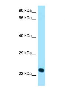 KLRK1 / CD314 / NKG2D Antibody - KLRK1 / NKG2D antibody western blot of 435S Cell lysate. Antibody concentration 1 ug/ml.  This image was taken for the unconjugated form of this product. Other forms have not been tested.