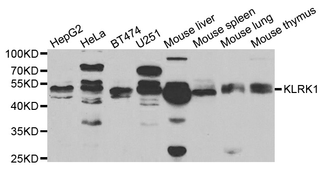 KLRK1 / CD314 / NKG2D Antibody - Western blot analysis of extracts of various cell lines, using KLRK1 antibody.