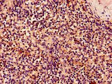 KLRK1 / CD314 / NKG2D Antibody - Immunohistochemistry of paraffin-embedded human spleen tissue using KLRK1 Antibody at dilution of 1:100
