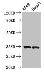 KLRK1 / CD314 / NKG2D Antibody - Western Blot Positive WB detected in: A549 whole cell lysate, HepG2 whole cell lysate All lanes: KLRK1 antibody at 3.7µg/ml Secondary Goat polyclonal to rabbit IgG at 1/50000 dilution Predicted band size: 26 kDa Observed band size: 34 kDa