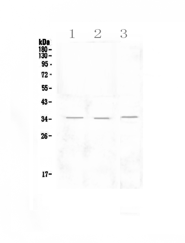 KLRK1 / CD314 / NKG2D Antibody - Western blot - Anti-NKG2D Picoband antibody