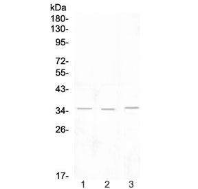 KLRK1 / CD314 / NKG2D Antibody - Western blot testing of 1) rat lymph, 2) rat spleen and 3) mouse thymus tissue lysate with NKG2D antibody at 0.5ug/ml. Predicted molecular weight ~25 kDa (unmodified), ~35 kDa (glycosylated).