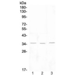 KLRK1 / CD314 / NKG2D Antibody - Western blot testing of 1) rat lymph, 2) rat spleen and 3) mouse thymus tissue lysate with NKG2D antibody at 0.5ug/ml. Predicted molecular weight ~25 kDa (unmodified), ~35 kDa (glycosylated).