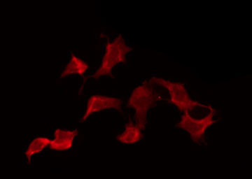 KLRK1 / CD314 / NKG2D Antibody - Staining NIH-3T3 cells by IF/ICC. The samples were fixed with PFA and permeabilized in 0.1% Triton X-100, then blocked in 10% serum for 45 min at 25°C. The primary antibody was diluted at 1:200 and incubated with the sample for 1 hour at 37°C. An Alexa Fluor 594 conjugated goat anti-rabbit IgG (H+L) Ab, diluted at 1/600, was used as the secondary antibody.