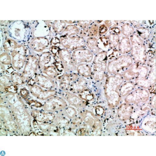 KLRK1 / CD314 / NKG2D Antibody - Immunohistochemical analysis of paraffin-embedded human-kidney, antibody was diluted at 1:200.