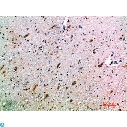 KLRK1 / CD314 / NKG2D Antibody - Immunohistochemical analysis of paraffin-embedded human-brain, antibody was diluted at 1:200.