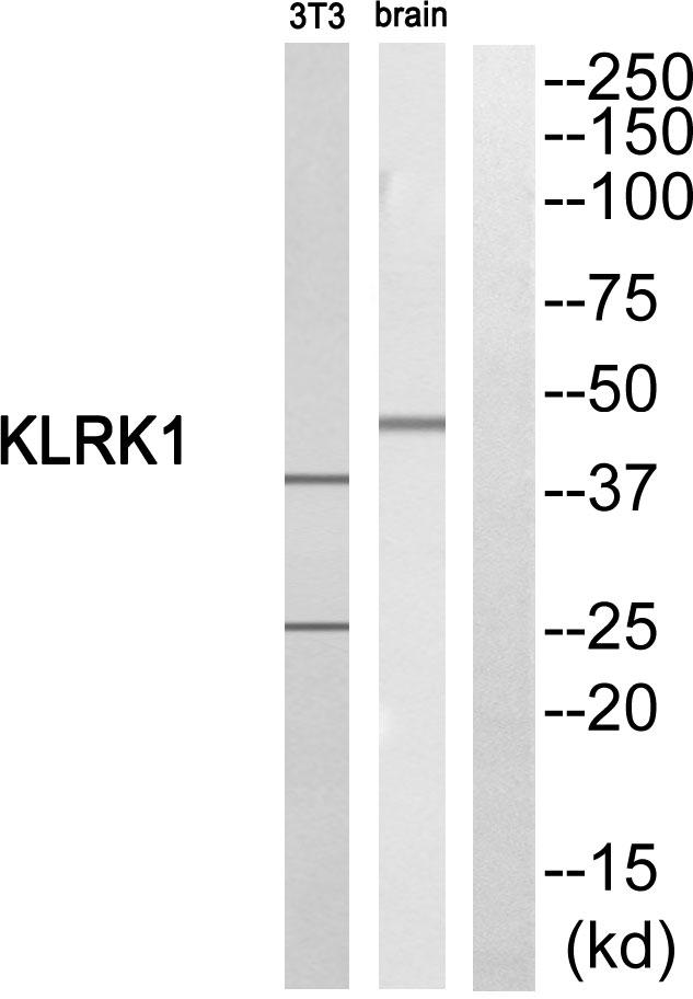 KLRK1 / CD314 / NKG2D Antibody - Western blot analysis of extracts from NIH/3T3 cells and rat brain cells, using KLRK1 antibody.
