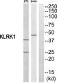 KLRK1 / CD314 / NKG2D Antibody - Western blot analysis of extracts from NIH/3T3 cells and rat brain cells, using KLRK1 antibody.