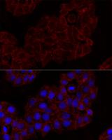 KLRK1 / CD314 / NKG2D Antibody - Immunofluorescence analysis of HeLa cells using KLRK1 Polyclonal Antibody at dilution of 1:100.Blue: DAPI for nuclear staining.