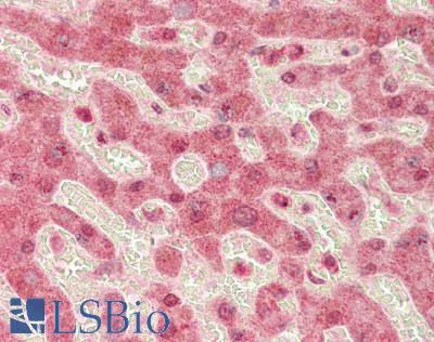 KMO Antibody - Human Liver: Formalin-Fixed, Paraffin-Embedded (FFPE)