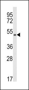 KMO Antibody - Western blot of KMO Antibody in CEM cell line lysates (35 ug/lane). KMO (arrow) was detected using the purified antibody.