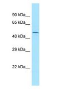 KMO Antibody - KMO antibody Western Blot of OVCAR-3.  This image was taken for the unconjugated form of this product. Other forms have not been tested.
