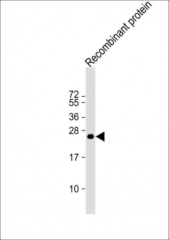 KMT2C / MLL3 Antibody - Anti-MLL3 Antibody at 1:2000 dilution + Recombinant protein at 20 ng per lane. Secondary Goat Anti-mouse IgG, (H+L), Peroxidase conjugated at 1/10000 dilution. Predicted band size: 541 kDa Blocking/Dilution buffer: 5% NFDM/TBST.