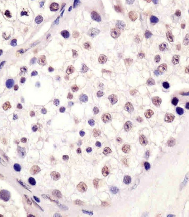 KMT2C / MLL3 Antibody - MLL3 Antibody (N-term) staining MLL3 in human testis tissue sections by Immunohistochemistry (IHC-P - paraformaldehyde-fixed, paraffin-embedded sections). Tissue was fixed with formaldehyde and blocked with 3% BSA for 0. 5 hour at room temperature; antigen retrieval was by heat mediation with a citrate buffer (pH6). Samples were incubated with primary antibody (1/25) for 1 hours at 37°C. A undiluted biotinylated goat polyvalent antibody was used as the secondary antibody.