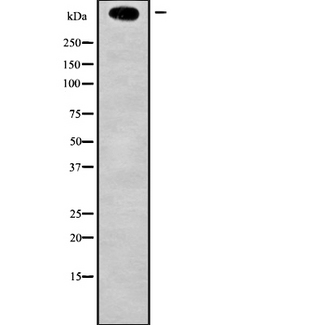 KMT2D / MLL2 Antibody - Western blot analysis of MLL2 using Jurkat whole cells lysates