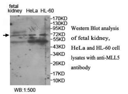 KMT2E / MLL5 Antibody - Western blot of KMT2E / MLL5 antibody