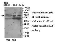 KMT2E / MLL5 Antibody - Western blot of KMT2E / MLL5 antibody