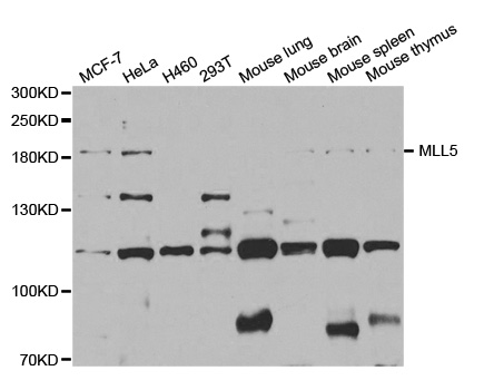 KMT2E / MLL5 Antibody - Western blot analysis of extracts of various cell lines, using MLL5 antibody.