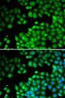 KMT2E / MLL5 Antibody - Immunofluorescence analysis of U20S cells.