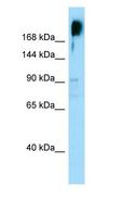 KNDC1 Antibody - KNDC1 antibody Western Blot of PANC1.  This image was taken for the unconjugated form of this product. Other forms have not been tested.