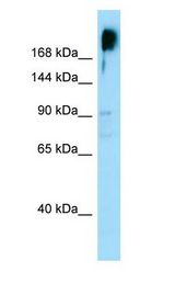 KNDC1 Antibody - KNDC1 antibody Western Blot of PANC1.  This image was taken for the unconjugated form of this product. Other forms have not been tested.