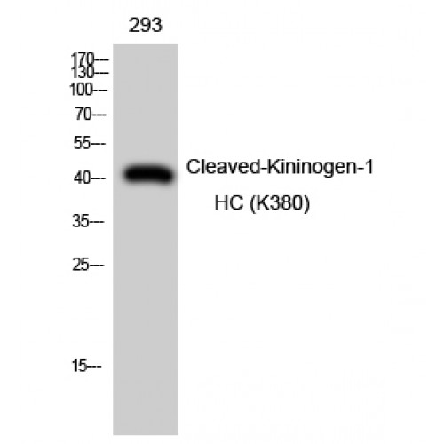 KNG1 / Kininogen / Bradykinin Antibody - Western blot of Cleaved-Kininogen-1 HC (K380) antibody