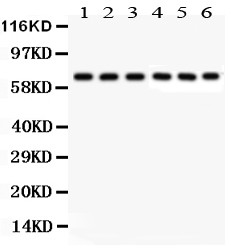 KNG1 / Kininogen / Bradykinin Antibody - Kininogen1 antibody Western blot. All lanes: Anti Kininogen1 at 0.5 ug/ml. Lane 1: U87 Whole Cell Lysate at 40 ug. Lane 2: MCF-7 Whole Cell Lysate at 40 ug. Lane 3: SKOV Whole Cell Lysate at 40 ug. Lane 4: SW620 Whole Cell Lysate at 40 ug. Lane 5: COLO320 Whole Cell Lysate at 40 ug. Lane 6: Human Placenta Tissue Lysate at 50 ug. Predicted band size: 72 kD. Observed band size: 72 kD.