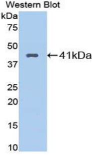 KNG1 / Kininogen / Bradykinin Antibody - Western blot of KNG1 / Kininogen / Bradykinin antibody.