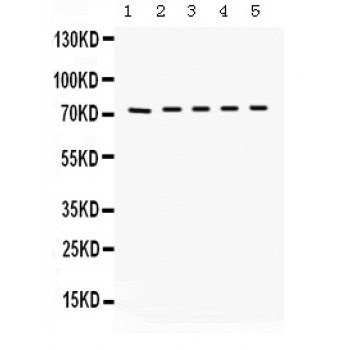 KNG1 / Kininogen / Bradykinin Antibody - Kininogen 1 antibody Western blot. All lanes: Anti Kininogen 1 at 0.5 ug/ml. Lane 1: Mouse Lung Tissue Lysate at 50 ug. Lane 2: Mouse Testis Tissue Lysate at 50 ug. Lane 3: Mouse Liver Tissue Lysate at 50 ug. Lane 4: HEPA Whole Cell Lysate at 40 ug. Lane 5: NEURO Whole Cell Lysate at 40 ug. Predicted band size: 73 kD. Observed band size: 73 kD.