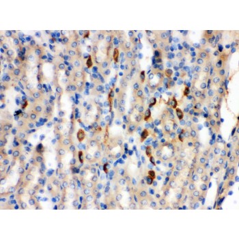KNG1 / Kininogen / Bradykinin Antibody - Kininogen 1 antibody IHC-paraffin. IHC(P): Mouse Kidney Tissue.