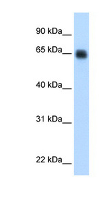 KNG1 / Kininogen / Bradykinin Antibody - KNG1 / Kininogen antibody Western blot of Fetal Liver lysate. This image was taken for the unconjugated form of this product. Other forms have not been tested.