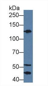 KNG1 / Kininogen / Bradykinin Antibody - Western Blot; Sample: Human Serum; ;Primary Ab: 5µg/ml Rabbit Anti-Human KNG1 Antibody;Second Ab: 0.2µg/mL HRP-Linked Caprine Anti-Rabbit IgG Polyclonal Antibody;