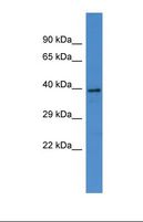 KNG1 / Kininogen / Bradykinin Antibody - Western blot of Human Placenta . KNG1 antibody dilution 1.0 ug/ml.  This image was taken for the unconjugated form of this product. Other forms have not been tested.
