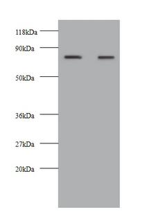 KNG1 / Kininogen / Bradykinin Antibody - Western blot of Kininogen-1 antibody at 2 ug/ml. Lane 1: EC109 whole cell lysate. Lane 2: 293T whole cell lysate. Secondary: Goat polyclonal to rabbit IgG at 1:10000 dilution. Predicted band size: 71 kDa. Observed band size: 71 kDa.  This image was taken for the unconjugated form of this product. Other forms have not been tested.