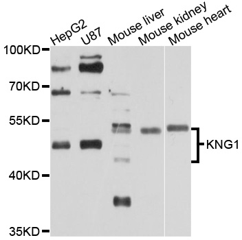 KNG1 / Kininogen / Bradykinin Antibody - Western blot analysis of extracts of various cell lines, using KNG1 antibody at 1:1000 dilution. The secondary antibody used was an HRP Goat Anti-Rabbit IgG (H+L) at 1:10000 dilution. Lysates were loaded 25ug per lane and 3% nonfat dry milk in TBST was used for blocking. An ECL Kit was used for detection and the exposure time was 30s.