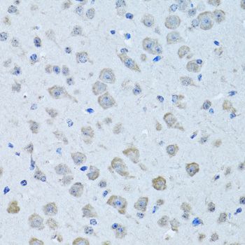 KNG1 / Kininogen / Bradykinin Antibody - Immunohistochemistry of paraffin-embedded rat brain using KNG1 antibody at dilution of 1:100 (40x lens).