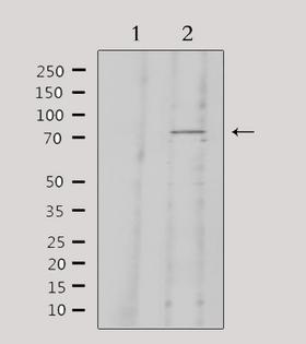 KNG1 / Kininogen / Bradykinin Antibody - Western blot analysis of extracts of 293 cells using KNG1 antibody. Lane 1 was treated with the antigen-specific peptide.
