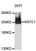 KNTC1 / ROD Antibody - Western blot analysis of extracts of 293T cells, using KNTC1 antibody at 1:3000 dilution. The secondary antibody used was an HRP Goat Anti-Rabbit IgG (H+L) at 1:10000 dilution. Lysates were loaded 25ug per lane and 3% nonfat dry milk in TBST was used for blocking. An ECL Kit was used for detection and the exposure time was 30s.