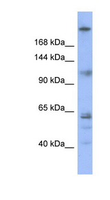 KNTC1 / ROD Antibody - KNTC1 antibody Western blot of OVCAR-3 cell lysate. This image was taken for the unconjugated form of this product. Other forms have not been tested.
