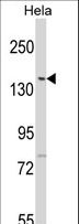 KPI-2 / LMTK2 Antibody - Western blot of LTK2 N-term in HeLa cell line lysates (35 ug/lane). LTK2 (arrow) was detected using the purified antibody.