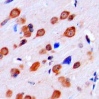 KPI-2 / LMTK2 Antibody - Immunohistochemical analysis of LMTK2 staining in human brain formalin fixed paraffin embedded tissue section. The section was pre-treated using heat mediated antigen retrieval with sodium citrate buffer (pH 6.0). The section was then incubated with the antibody at room temperature and detected using an HRP conjugated compact polymer system. DAB was used as the chromogen. The section was then counterstained with hematoxylin and mounted with DPX.